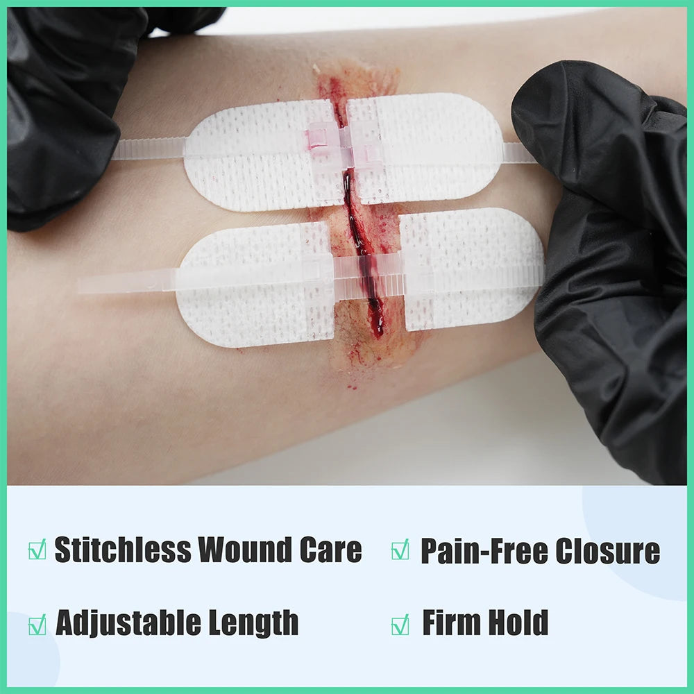 RHINO RESCUE Zip Stitch 6pcs with Wound Dresssings, Wound Closure Strips, Zipstitch Laceration Closure Kit for Cut Care Band-aid